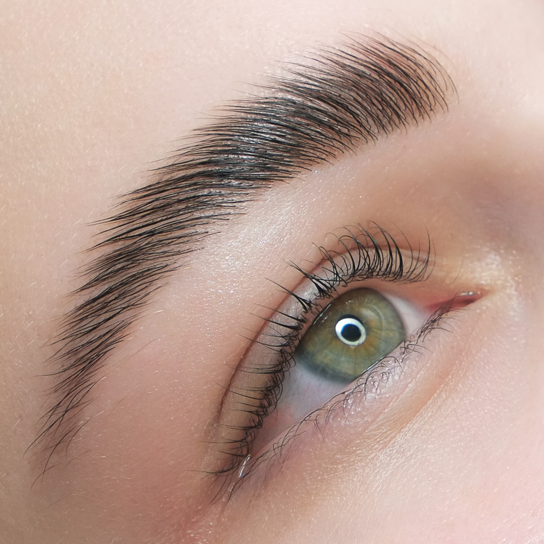 Behandlungen 105 Lifting